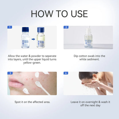 Acne-Clearing Lotion Plus – Unclogs Pores & Fades Marks Overnight(1.8% Encapsulated Salicylic Acid,4% Niacinamide - Exfoliates Blemishes for Oily, Acne-Prone Skin)