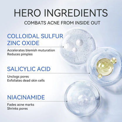 Acne-Clearing Lotion Plus – Unclogs Pores & Fades Marks Overnight(1.8% Encapsulated Salicylic Acid,4% Niacinamide - Exfoliates Blemishes for Oily, Acne-Prone Skin)